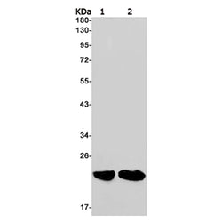 RAC3 rabbit monoclonal antibody