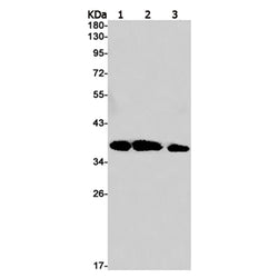 RAD51 rabbit monoclonal antibody