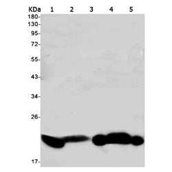 RAP1B rabbit monoclonal antibody