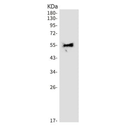 RARB rabbit monoclonal antibody