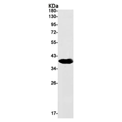 RASSF2 rabbit monoclonal antibody
