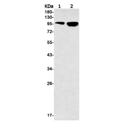 RB1 (phospho-Ser811) rabbit monoclonal antibody