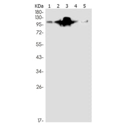 RB1 (phospho-Ser780) rabbit monoclonal antibody