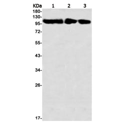 RB1 (phospho-Thr356) rabbit monoclonal antibody