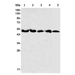 RBBP4 rabbit monoclonal antibody