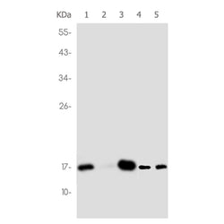 RBM3 rabbit monoclonal antibody