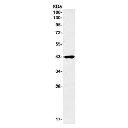RBM43 rabbit monoclonal antibody