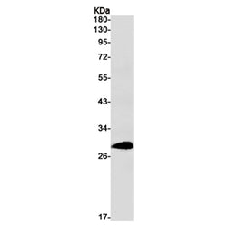 RCHY1 rabbit monoclonal antibody