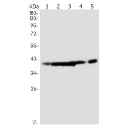 RNF2 rabbit monoclonal antibody