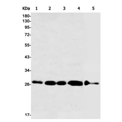 RPA2 rabbit monoclonal antibody