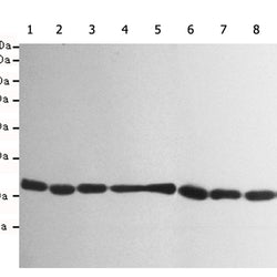 RPS6 rabbit monoclonal antibody