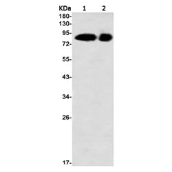 RPS6KA3 rabbit monoclonal antibody