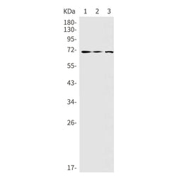RPS6KB1 rabbit monoclonal antibody