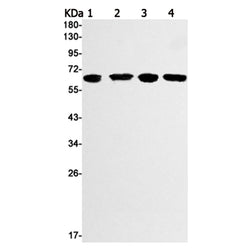 RPS6KB2 (phospho-Ser371) rabbit monoclonal antibody