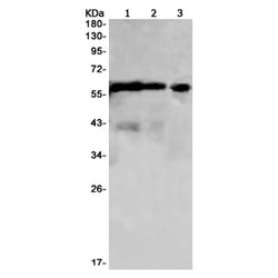 RPS6KB2 rabbit monoclonal antibody