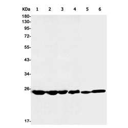 RPS8 rabbit monoclonal antibody