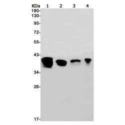 RPSA rabbit monoclonal antibody