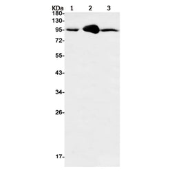 RRM1 rabbit monoclonal antibody