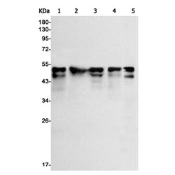 RUNX1/RUNX2/RUNX3 rabbit monoclonal antibody