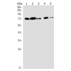 RYK rabbit monoclonal antibody