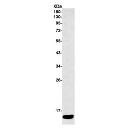 S100A4 rabbit monoclonal antibody