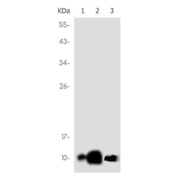 S100A6 rabbit monoclonal antibody