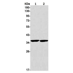 SAE1 rabbit monoclonal antibody
