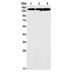 SAFB rabbit monoclonal antibody