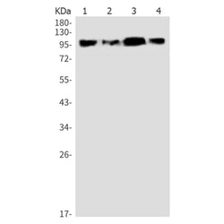SATB1 rabbit monoclonal antibody