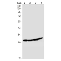 SBDS rabbit monoclonal antibody