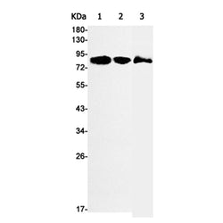 SCARB1 rabbit monoclonal antibody
