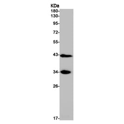 SCD rabbit monoclonal antibody