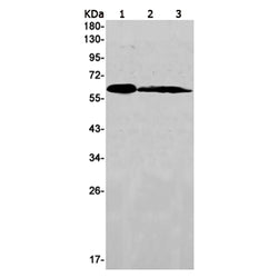 SDC3 rabbit monoclonal antibody