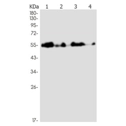 SERPINA1 rabbit monoclonal antibody