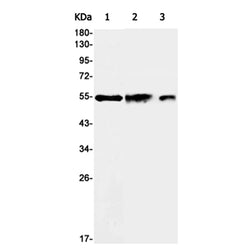 SESN2 rabbit monoclonal antibody