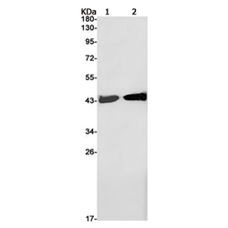 SET rabbit monoclonal antibody