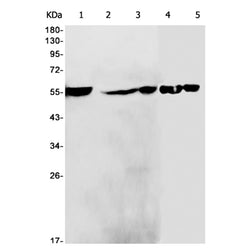 SFRP4 rabbit monoclonal antibody