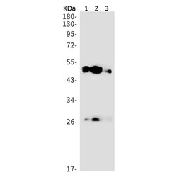 SHH rabbit monoclonal antibody