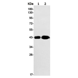 SIRT2 rabbit monoclonal antibody
