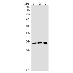 SLBP rabbit monoclonal antibody