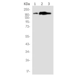 SMARCA2 rabbit monoclonal antibody