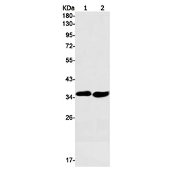 SMN1 rabbit monoclonal antibody