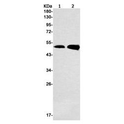SMYD3 rabbit monoclonal antibody