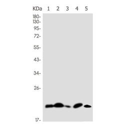 SNRPC rabbit monoclonal antibody