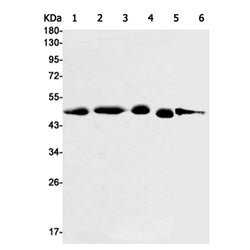 SNX5 rabbit monoclonal antibody