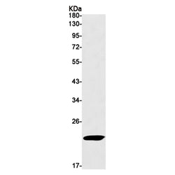 SOCS2 rabbit monoclonal antibody