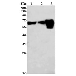SQSTM1 rabbit monoclonal antibody