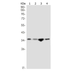 SRR rabbit monoclonal antibody