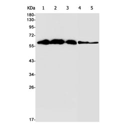 STIP1 rabbit monoclonal antibody