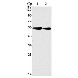 STK26 rabbit monoclonal antibody